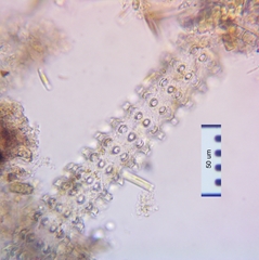 Triploceras verticillatum