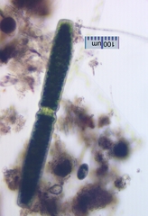 Pleurotaenium maximum