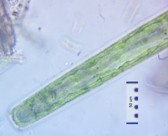Pleurotaenium