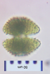 Staurastrum brebissonii