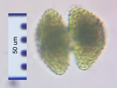 Staurastrum brebissonii
