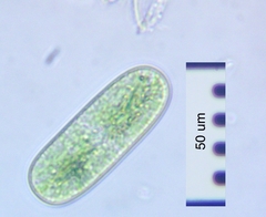 Cylindrocystis