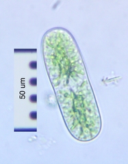 Cylindrocystis