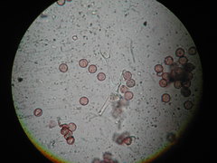 Physarum globuliferum