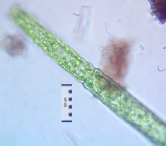 Pleurotaenium trabecula