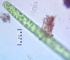 Pleurotaenium trabecula