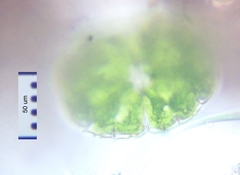 Micrasterias truncata