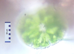 Micrasterias truncata