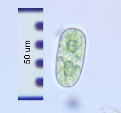 Cylindrocystis