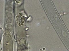 Peziza atrovinosa