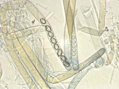 Peziza atrovinosa