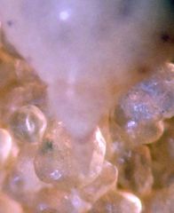 Acyrthosiphon macrosiphum