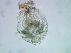 Brachionus angularis