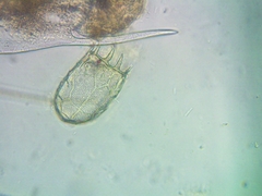 Keratella cochlearis