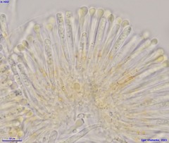 Orbilia xanthostigma