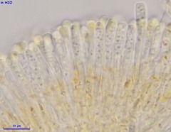 Orbilia xanthostigma