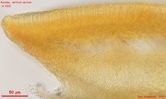 Orbilia xanthostigma