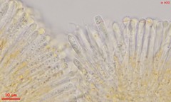 Orbilia xanthostigma