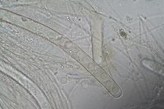 Plicaria endocarpoides