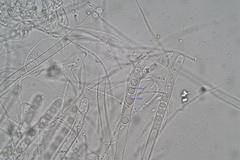 Pulvinula archeri