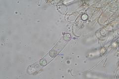 Pulvinula tetraspora