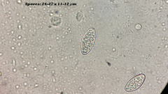 Trichophaea gregaria