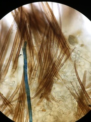 Trichophaea gregaria