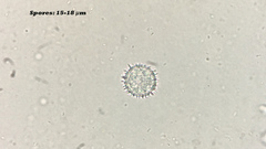 Ramsbottomia asperior