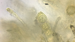 Ramsbottomia asperior