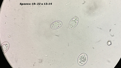 Trichophaea woolhopeia