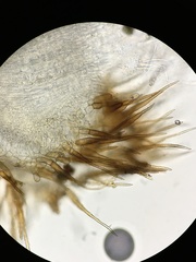 Trichophaea woolhopeia