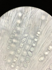 Trichophaea woolhopeia