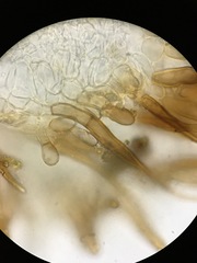 Trichophaea woolhopeia