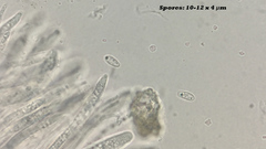 Hymenoscyphus imberbis