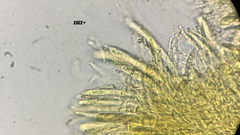 Hymenoscyphus imberbis