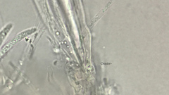 Hymenoscyphus imberbis