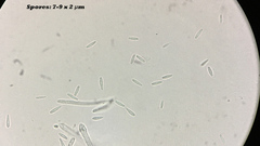 Lachnum subvirgineum