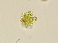 Coelastrum astroideum