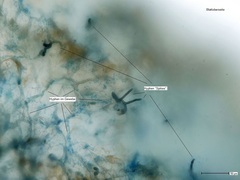 Cronartium ribicola