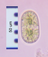 Cylindrocystis