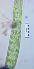 Pleurotaenium