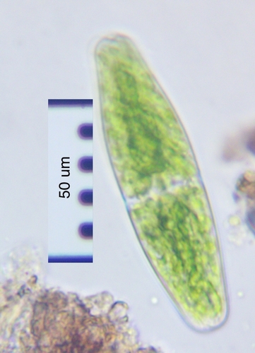 Tetmemorus laevis
