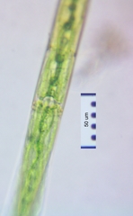 Closterium baillyanum