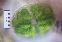 Micrasterias truncata