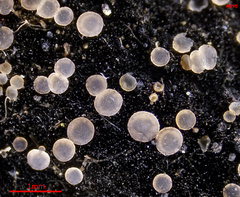 Orbilia xanthostigma