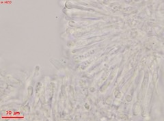 Orbilia xanthostigma