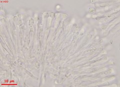 Orbilia xanthostigma