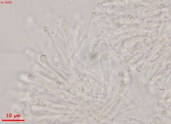 Orbilia xanthostigma