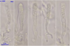 Orbilia xanthostigma