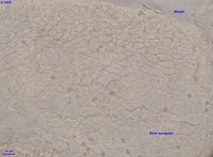 Orbilia xanthostigma